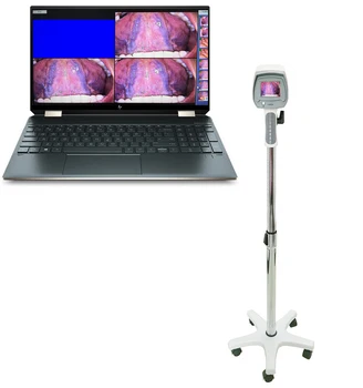 Venda quente ginecológico de auto-verificação endoscópio digital eletrônica portátil colposcópio
